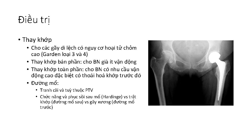 Gy U Trn g I S Babazadeh Gii