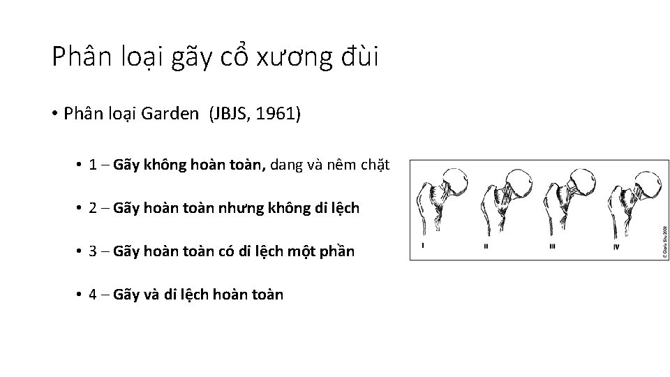 Gy U Trn g I S Babazadeh Gii