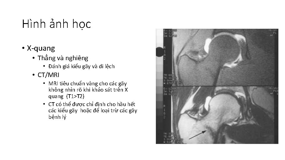 Gy U Trn g I S Babazadeh Gii