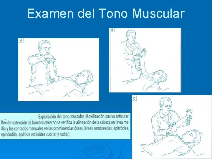 Examen del Tono Muscular 