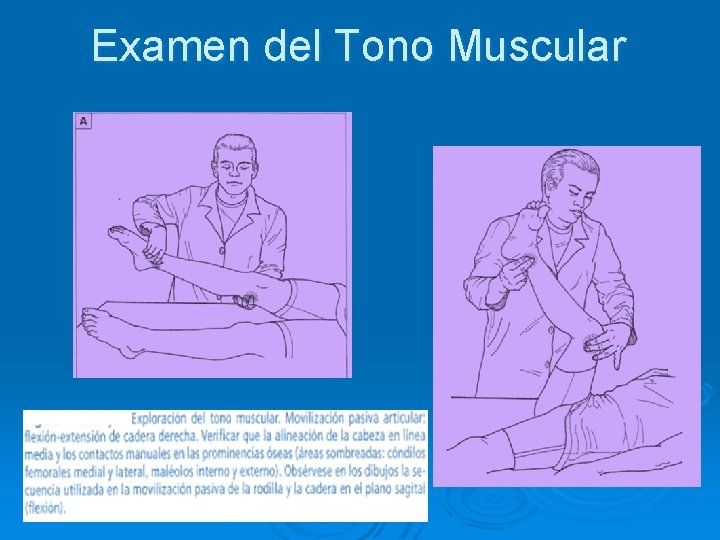 Examen del Tono Muscular 