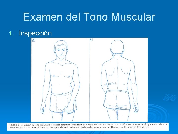 Examen del Tono Muscular 1. Inspección 