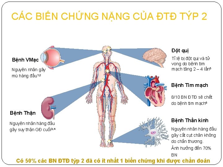 CÁC BIẾN CHỨNG NẶNG CỦA ĐTĐ TÝP 2 Đột quị Bệnh VMạc Nguyên nhân