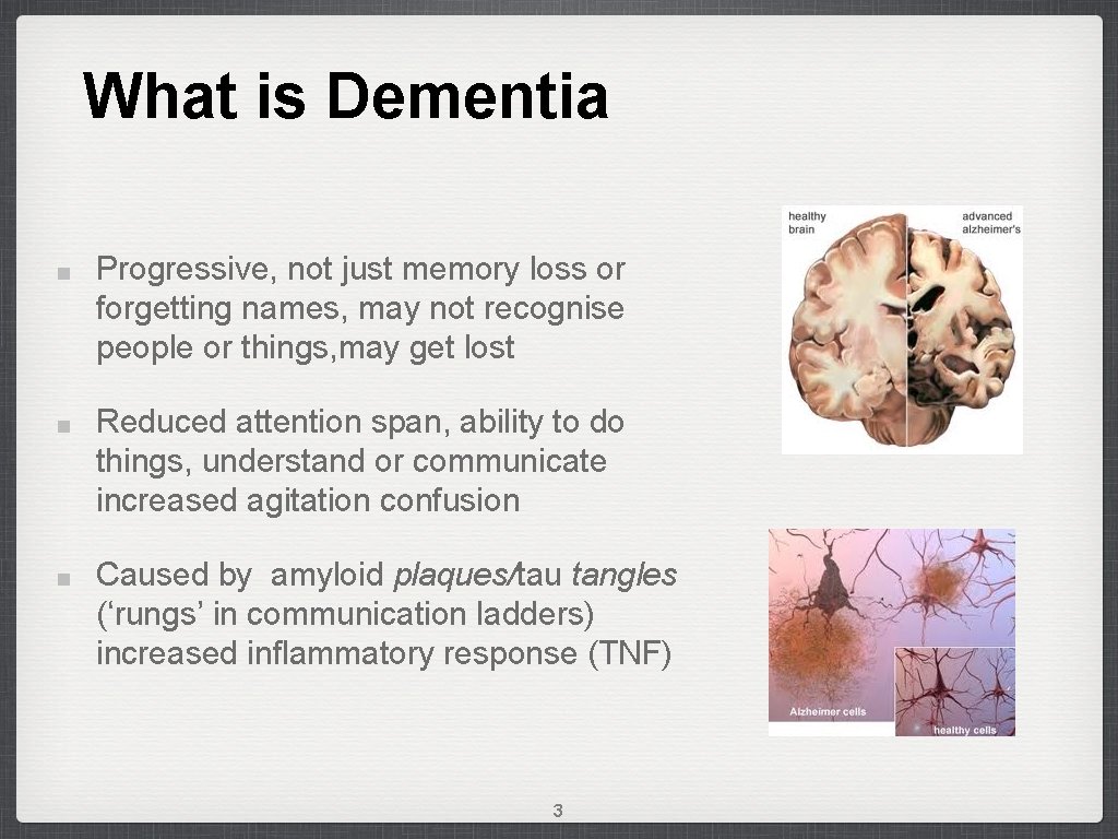 What is Dementia Progressive, not just memory loss or forgetting names, may not recognise