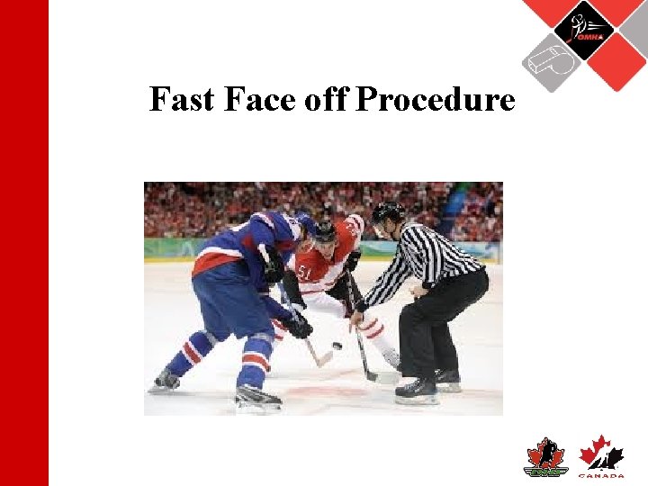 Fast Face off Procedure 