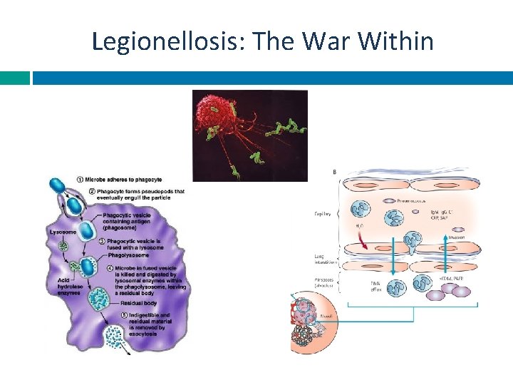 Legionellosis: The War Within 