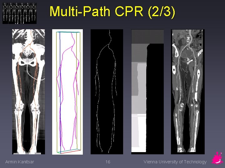 Multi-Path CPR (2/3) Armin Kanitsar 16 Vienna University of Technology 