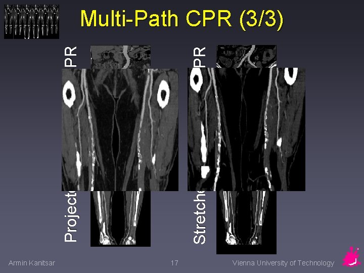 Armin Kanitsar Stretched – Multi-Path CPR Projected – Multi-Path CPR (3/3) 17 Vienna University