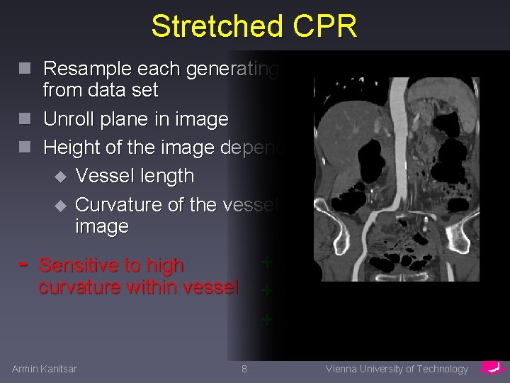 Stretched CPR n Resample each generating line from data set n Unroll plane in