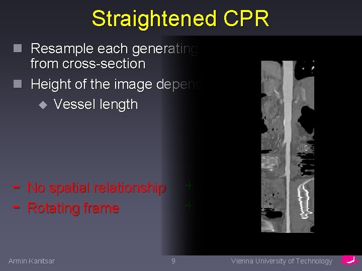 Straightened CPR n Resample each generating line from cross-section n Height of the image