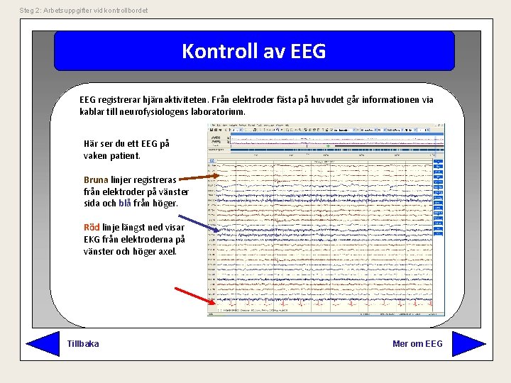 Steg 2: Arbetsuppgifter vid kontrollbordet Kontroll av EEG registrerar hjärnaktiviteten. Från elektroder fästa på