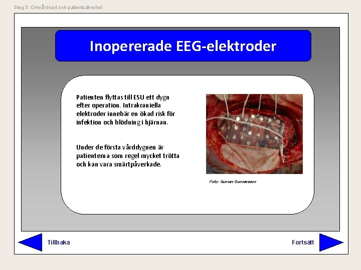 Steg 3: Omvårdnad och patientsäkerhet Inopererade EEG-elektroder Patienten flyttas till ESU ett dygn efter