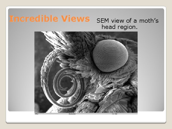 Incredible Views SEM view of a moth’s head region. 