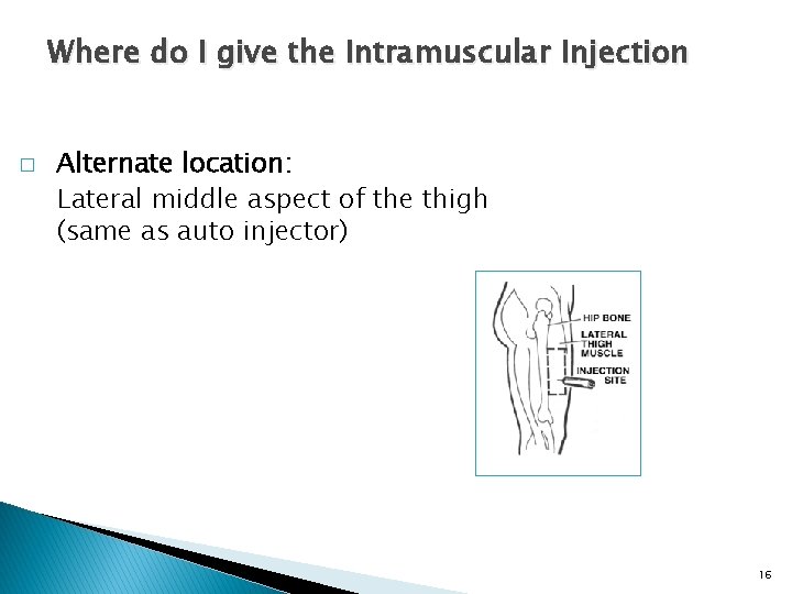 Where do I give the Intramuscular Injection � Alternate location: Lateral middle aspect of