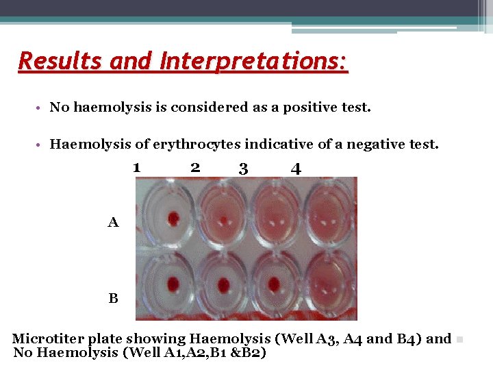 Results and Interpretations: • No haemolysis is considered as a positive test. • Haemolysis