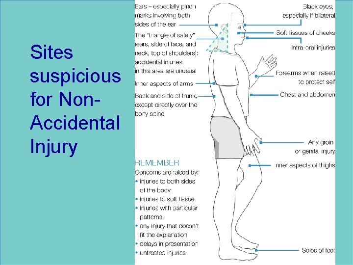 Sites suspicious for Non. Accidental Injury 