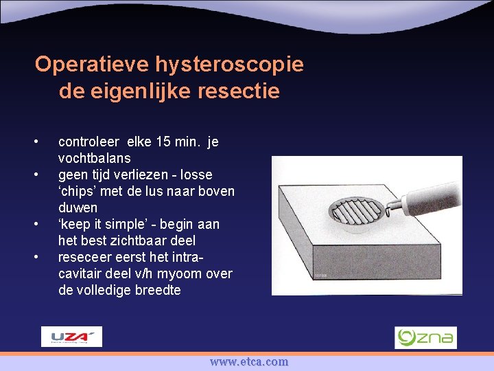 Operatieve hysteroscopie de eigenlijke resectie • • controleer elke 15 min. je vochtbalans geen