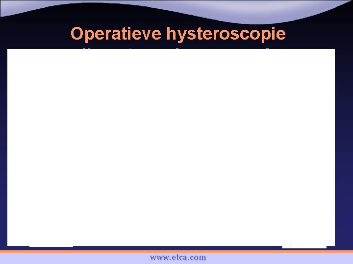 Operatieve hysteroscopie diameter – duur resectie www. etca. com 