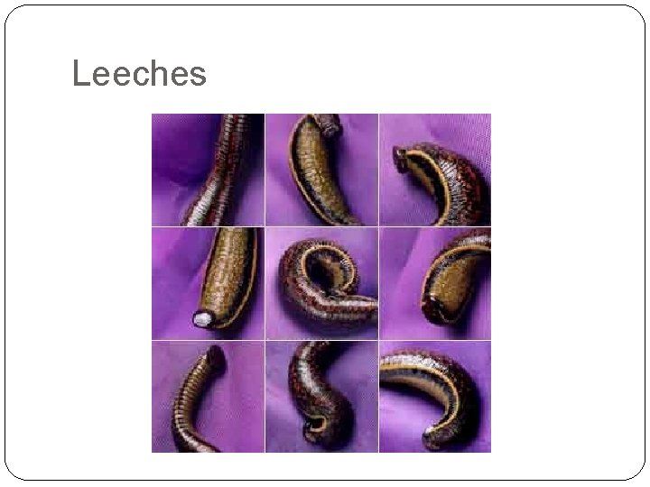 Leeches 