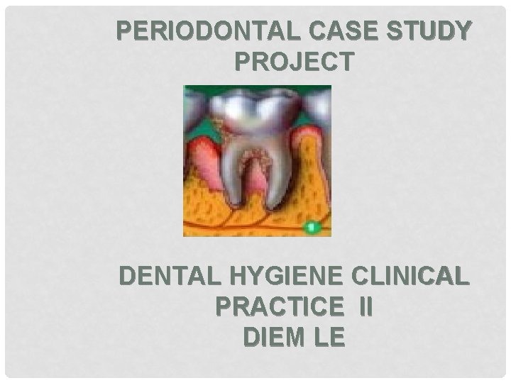 PERIODONTAL CASE STUDY PROJECT DENTAL HYGIENE CLINICAL PRACTICE II DIEM LE 