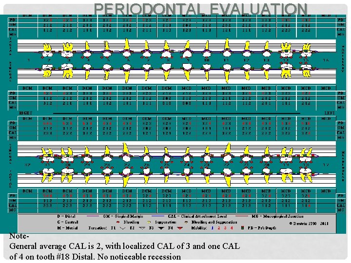 PERIODONTAL EVALUATION Note. General average CAL is 2, with localized CAL of 3 and