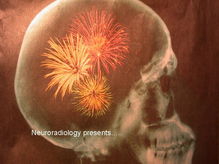 Neuroradiology presents…. . 