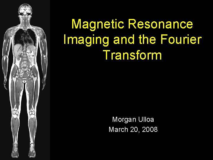 Magnetic Resonance Imaging and the Fourier Transform Morgan Ulloa March 20, 2008 
