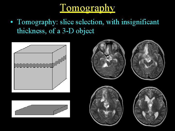 Tomography • Tomography: slice selection, with insignificant thickness, of a 3 -D object 