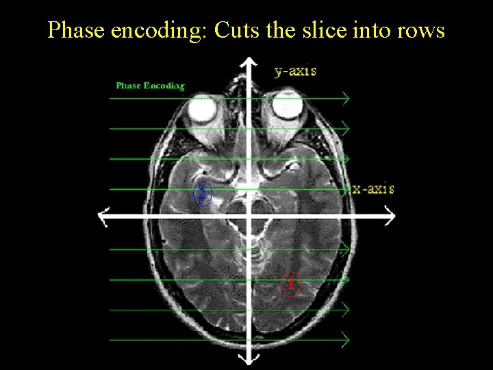 Phase encoding: Cuts the slice into rows 