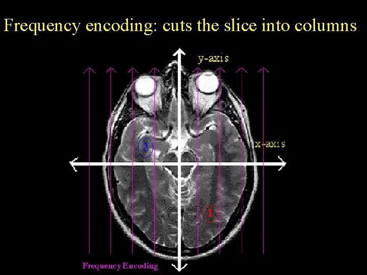 Frequency encoding: cuts the slice into columns 