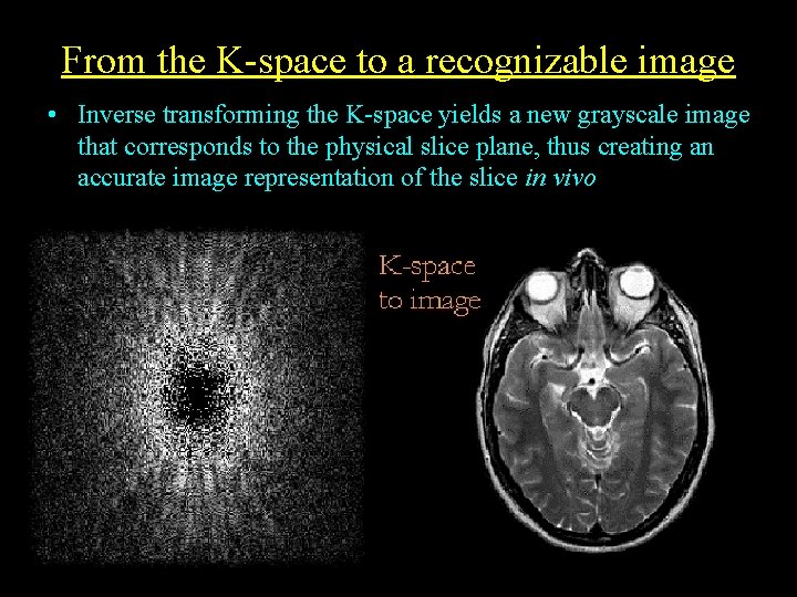 From the K-space to a recognizable image • Inverse transforming the K-space yields a