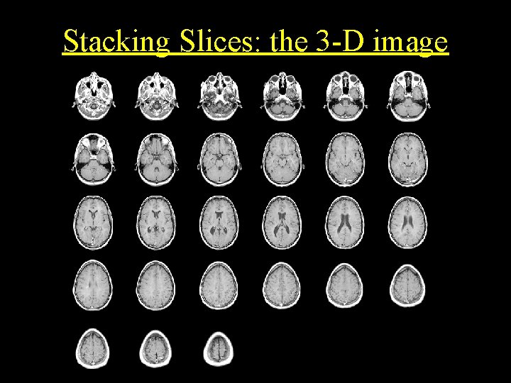 Stacking Slices: the 3 -D image 