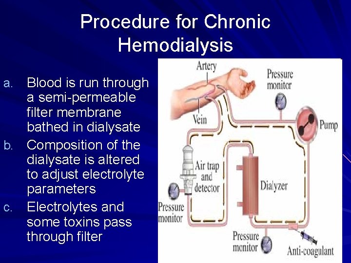 Procedure for Chronic Hemodialysis a. Blood is run through a semi-permeable filter membrane bathed