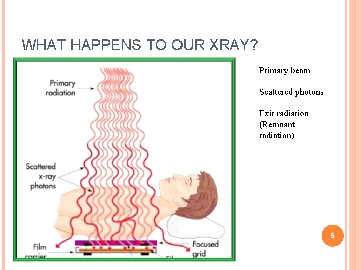 WHAT HAPPENS TO OUR XRAY? Primary beam Scattered photons Exit radiation (Remnant radiation) 5 WHAT HAPPENS TO OUR XRAY? Primary beam Scattered photons Exit radiation (Remnant radiation) 5