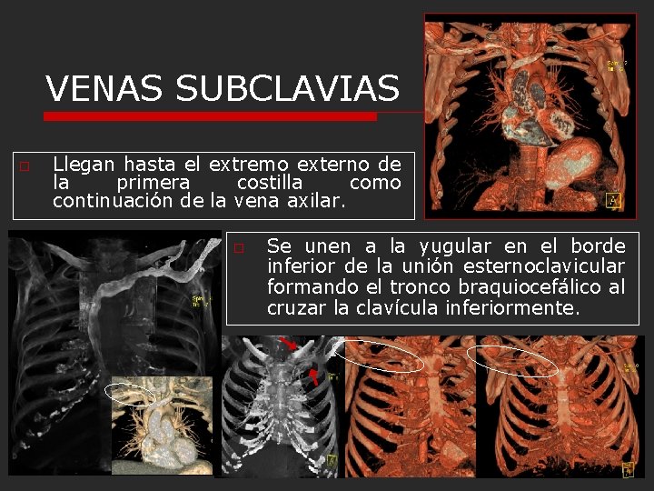 VENAS SUBCLAVIAS o Llegan hasta el extremo externo de la primera costilla como continuación
