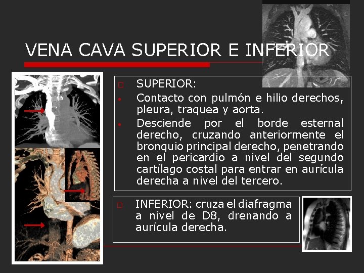 VENA CAVA SUPERIOR E INFERIOR o • • o SUPERIOR: Contacto con pulmón e