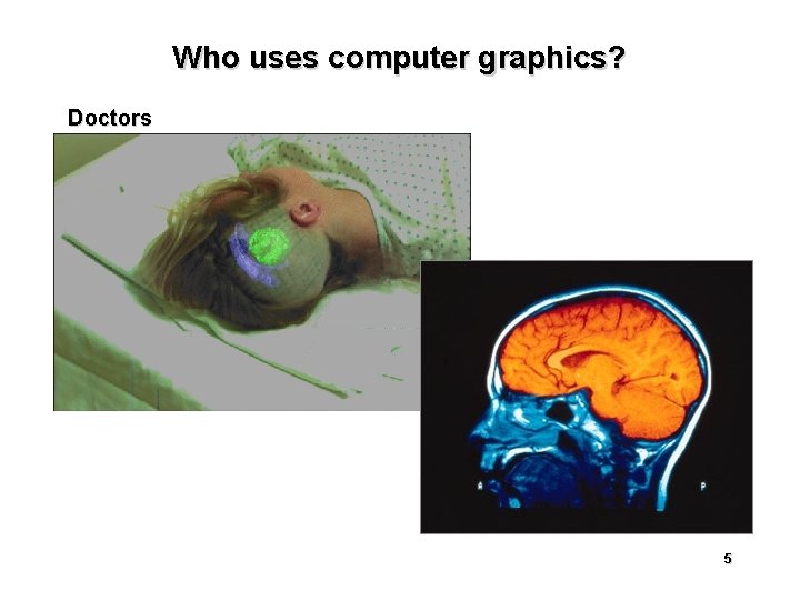 Who uses computer graphics? Doctors 5 