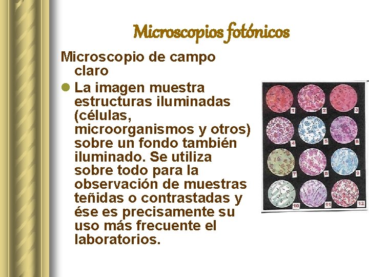 Microscopios fotónicos Microscopio de campo claro l La imagen muestra estructuras iluminadas (células, microorganismos