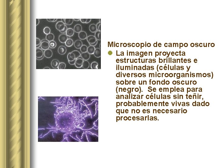 Microscopio de campo oscuro l La imagen proyecta estructuras brillantes e iluminadas (células y