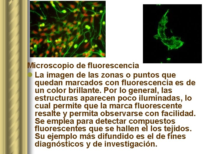 Microscopio de fluorescencia l La imagen de las zonas o puntos quedan marcados con