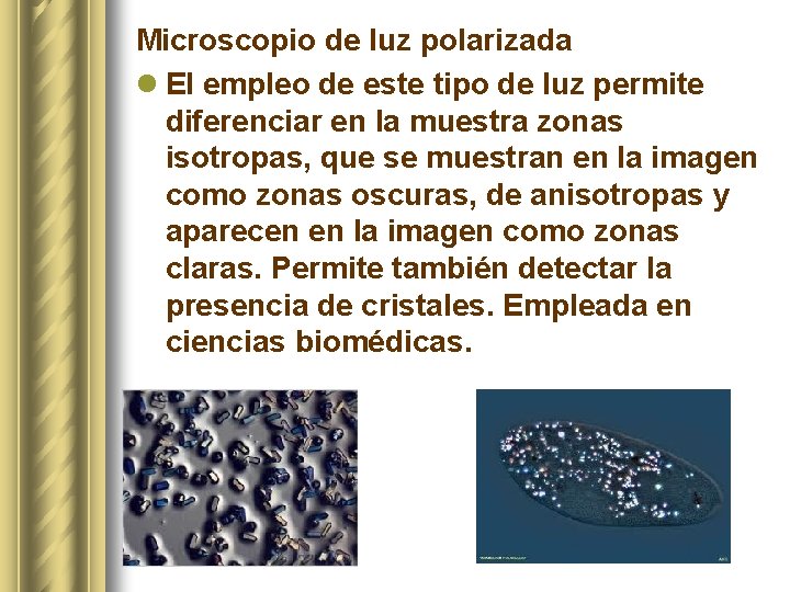 Microscopio de luz polarizada l El empleo de este tipo de luz permite diferenciar