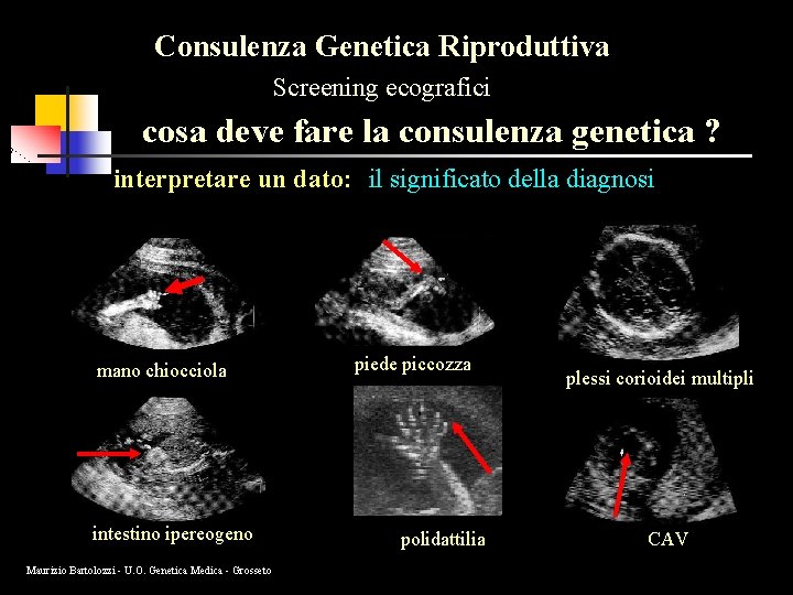 Consulenza Genetica Riproduttiva Screening ecografici cosa deve fare la consulenza genetica ? interpretare un