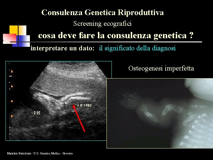 Consulenza Genetica Riproduttiva Screening ecografici cosa deve fare la consulenza genetica ? interpretare un