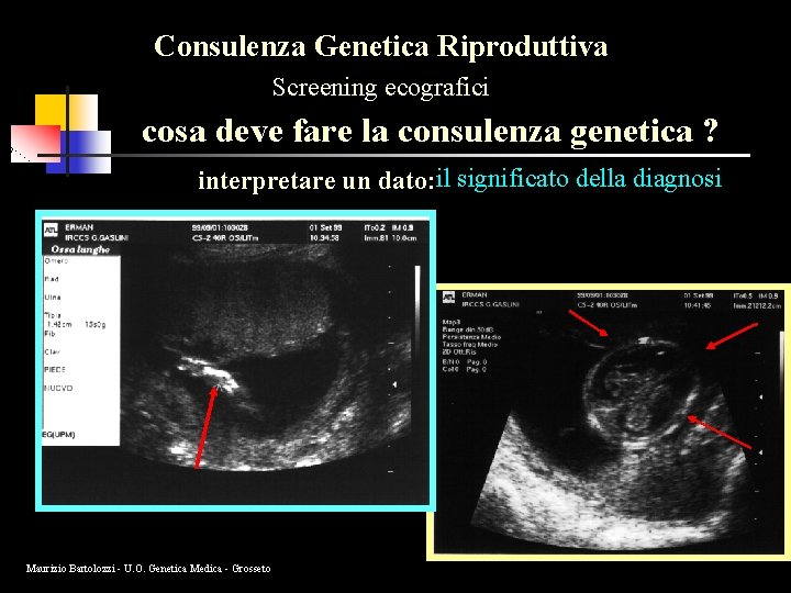 Consulenza Genetica Riproduttiva Screening ecografici cosa deve fare la consulenza genetica ? interpretare un