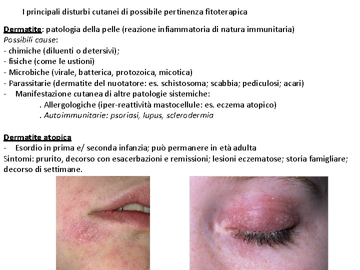 I pi comuni disturbi cutanei trattabili con PE