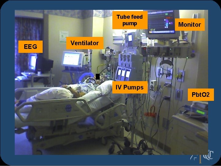 Tube feed pump EEG Monitor Ventilator IV Pumps Pbt. O 2 