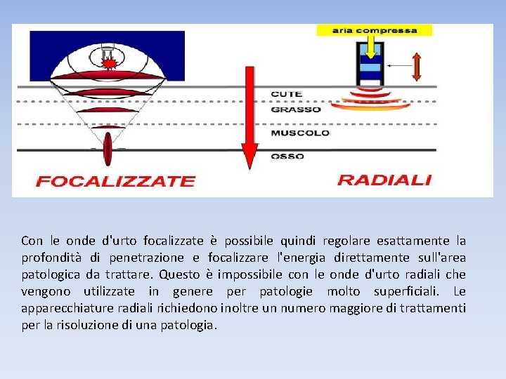 Con le onde d'urto focalizzate è possibile quindi regolare esattamente la profondità di penetrazione