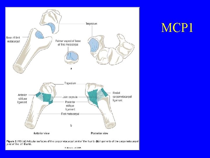 MCP 1 