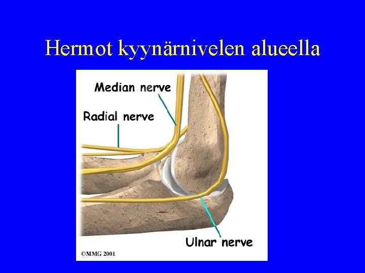 Hermot kyynärnivelen alueella 