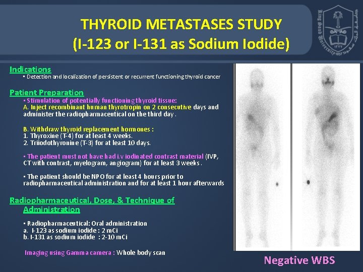 THYROID METASTASES STUDY (I-123 or I-131 as Sodium Iodide) Indications • Detection and localization